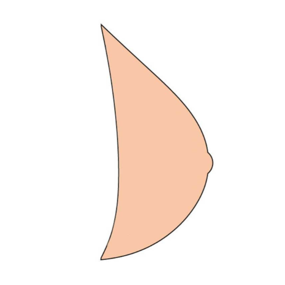 Amoena Essential Light 3E 556 Breast Shaper